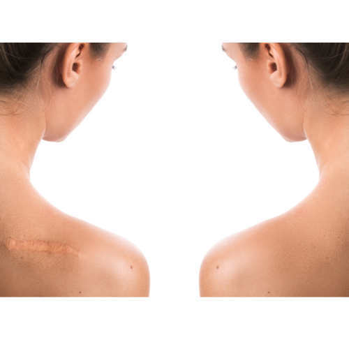 scar camouflage melbourne